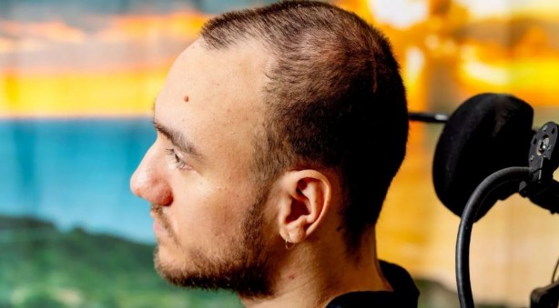 Foto - Beynine Neuralink çipi takılan kişiden açıklamalar! Neuralink beyin çipi nasıl çalışıyor?