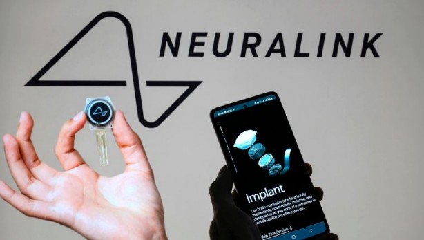 Beynine Neuralink çipi takılan kişiden açıklamalar! Neuralink beyin çipi nasıl çalışıyor?
