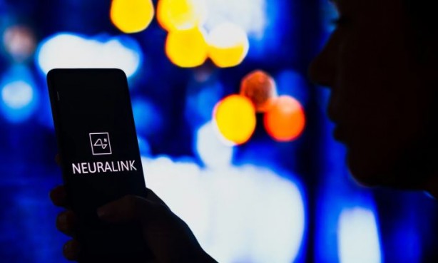 Foto - Beynine Neuralink çipi takılan kişiden açıklamalar! Neuralink beyin çipi nasıl çalışıyor?