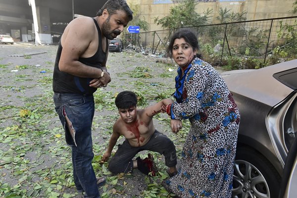 Foto - Beyrut'ta patlama sonrası korkunç görüntüler!