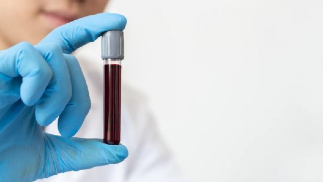 Foto - Bilim adamları açıkladı: Bu kan gurubu daha geç yaşlanıyor!