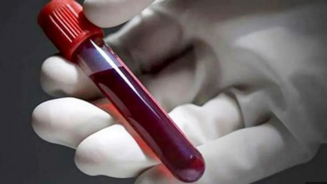 Foto - Bilim adamları açıkladı: Bu kan gurubu daha geç yaşlanıyor!