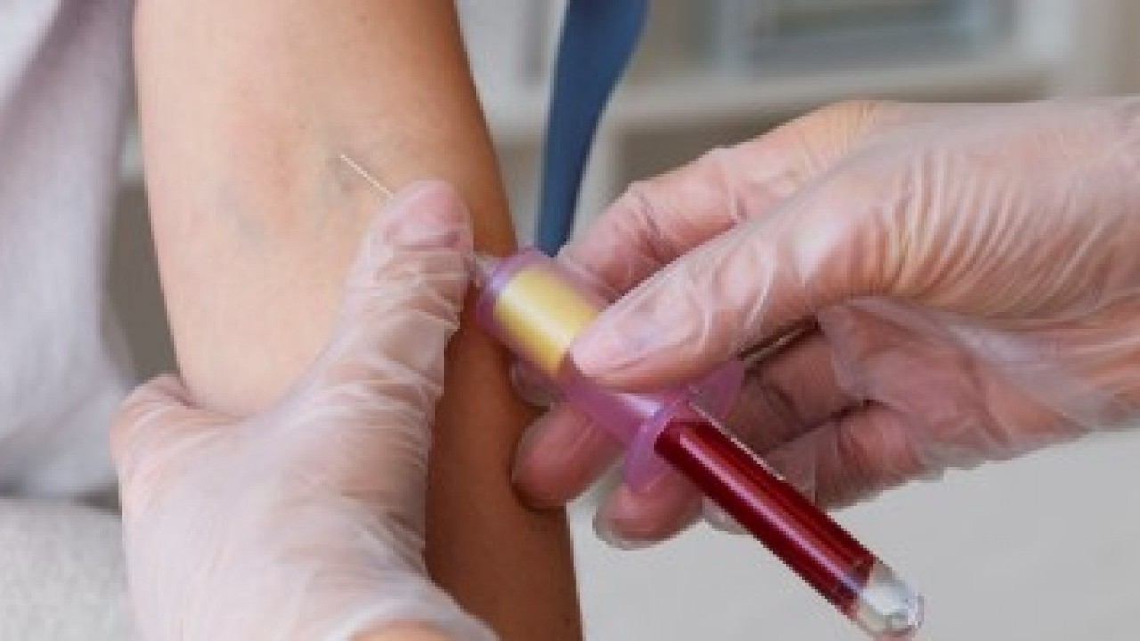 Foto - Bilim adamları açıkladı: Bu kan gurubu daha geç yaşlanıyor!