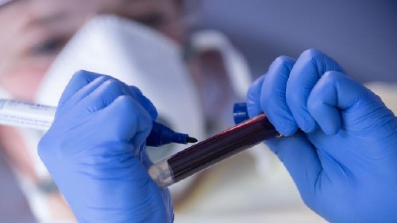 Foto - Bilim adamları açıkladı: Bu kan gurubu daha geç yaşlanıyor!