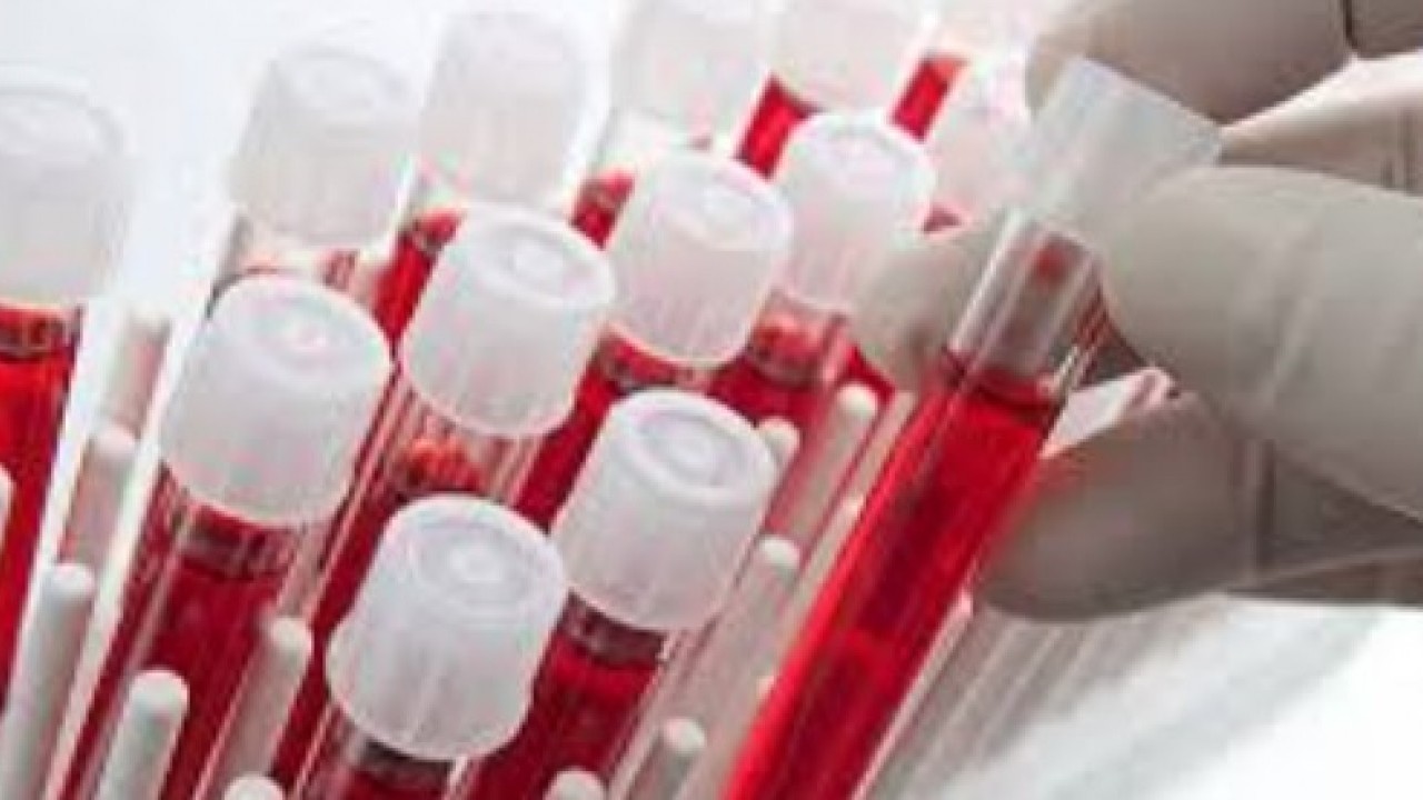 Foto - Bilim adamları açıkladı: Bu kan gurubu daha geç yaşlanıyor!