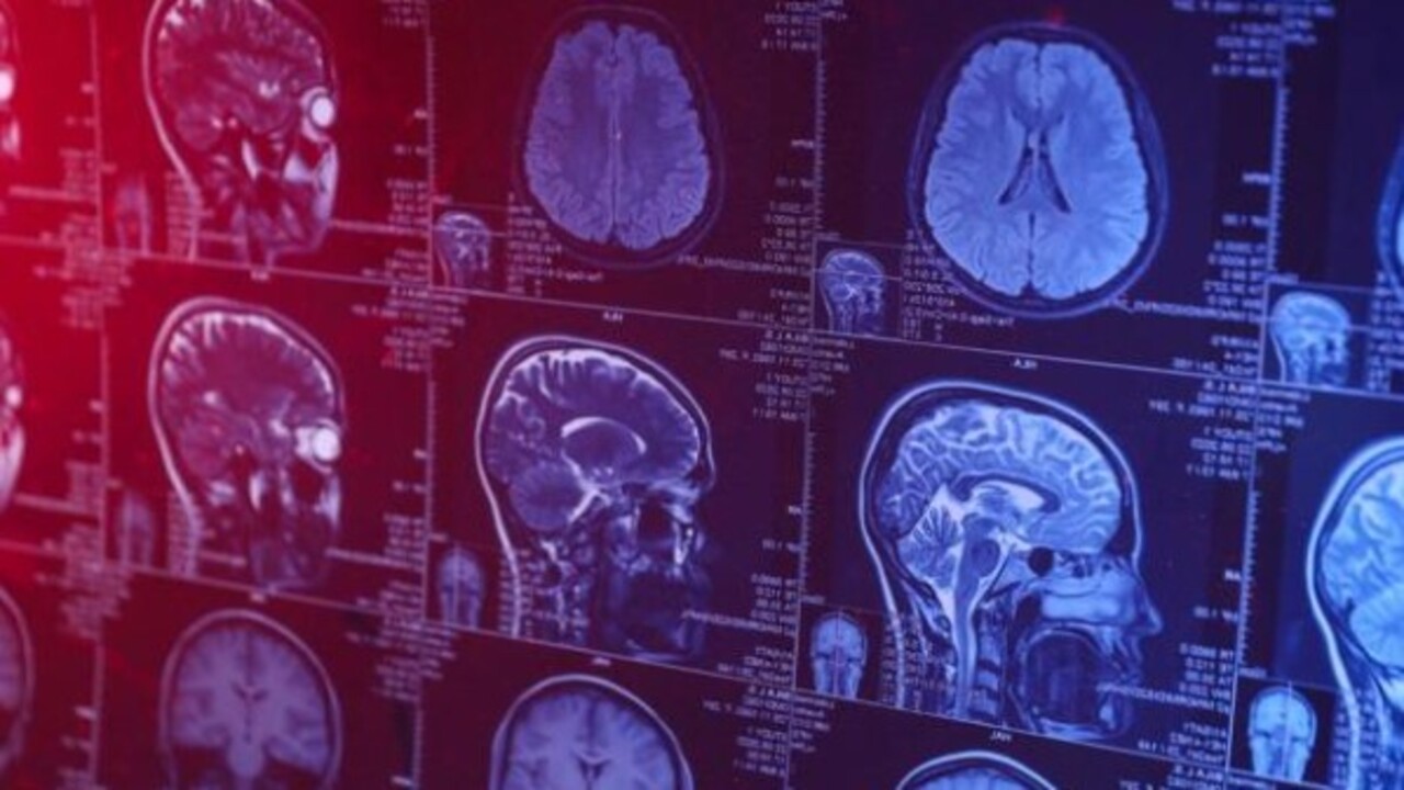 Foto - Bilim adamları ezber bozdu! Alzheimer babadan mı geçiyor