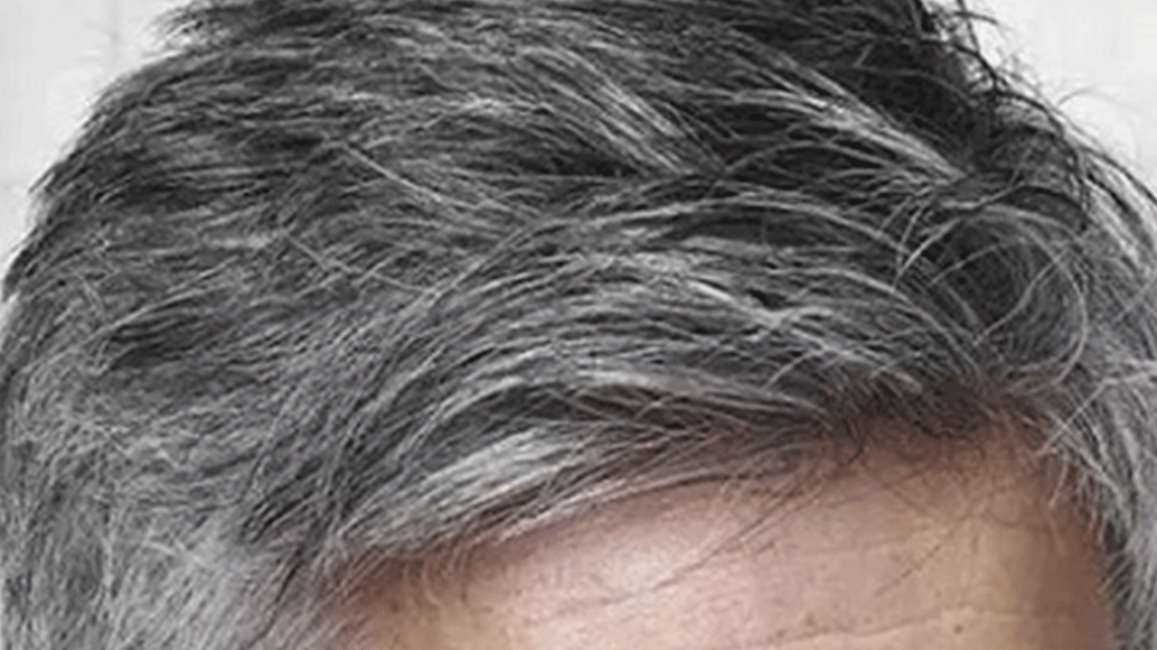 Foto - Bilim adamları son noktayı koydu: İşte erken yaşta saçların beyazlama nedeni!