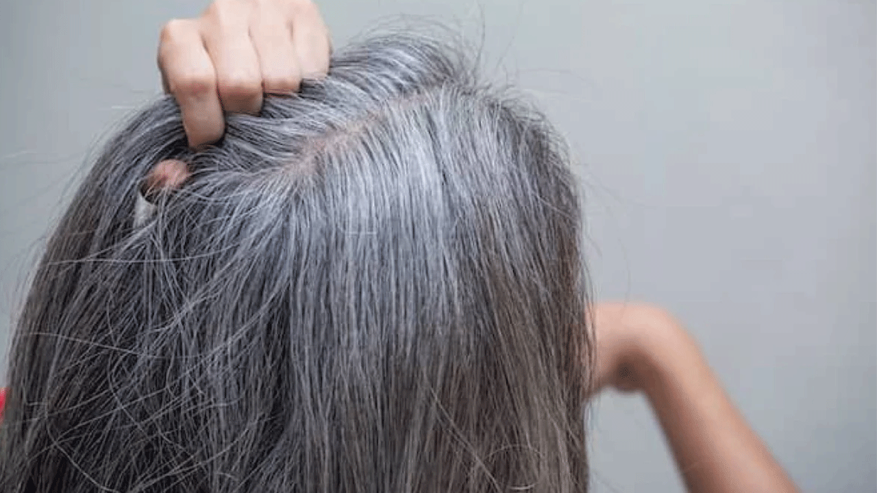 Foto - Bilim adamları son noktayı koydu: İşte erken yaşta saçların beyazlama nedeni!