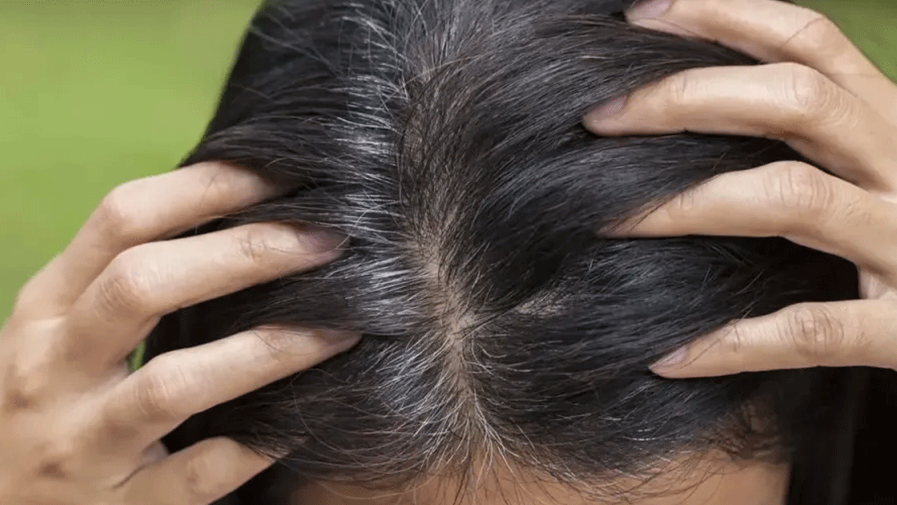 Foto - Bilim adamları son noktayı koydu: İşte erken yaşta saçların beyazlama nedeni!