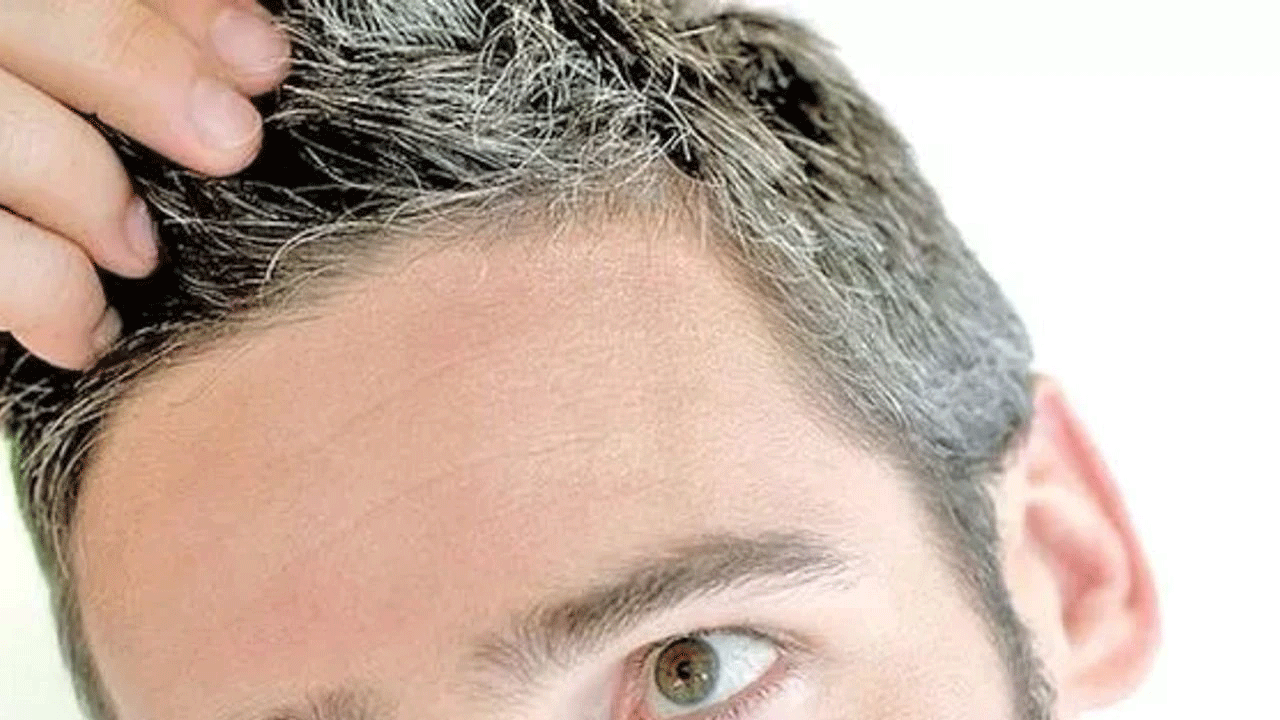 Foto - Bilim adamları son noktayı koydu: İşte erken yaşta saçların beyazlama nedeni!