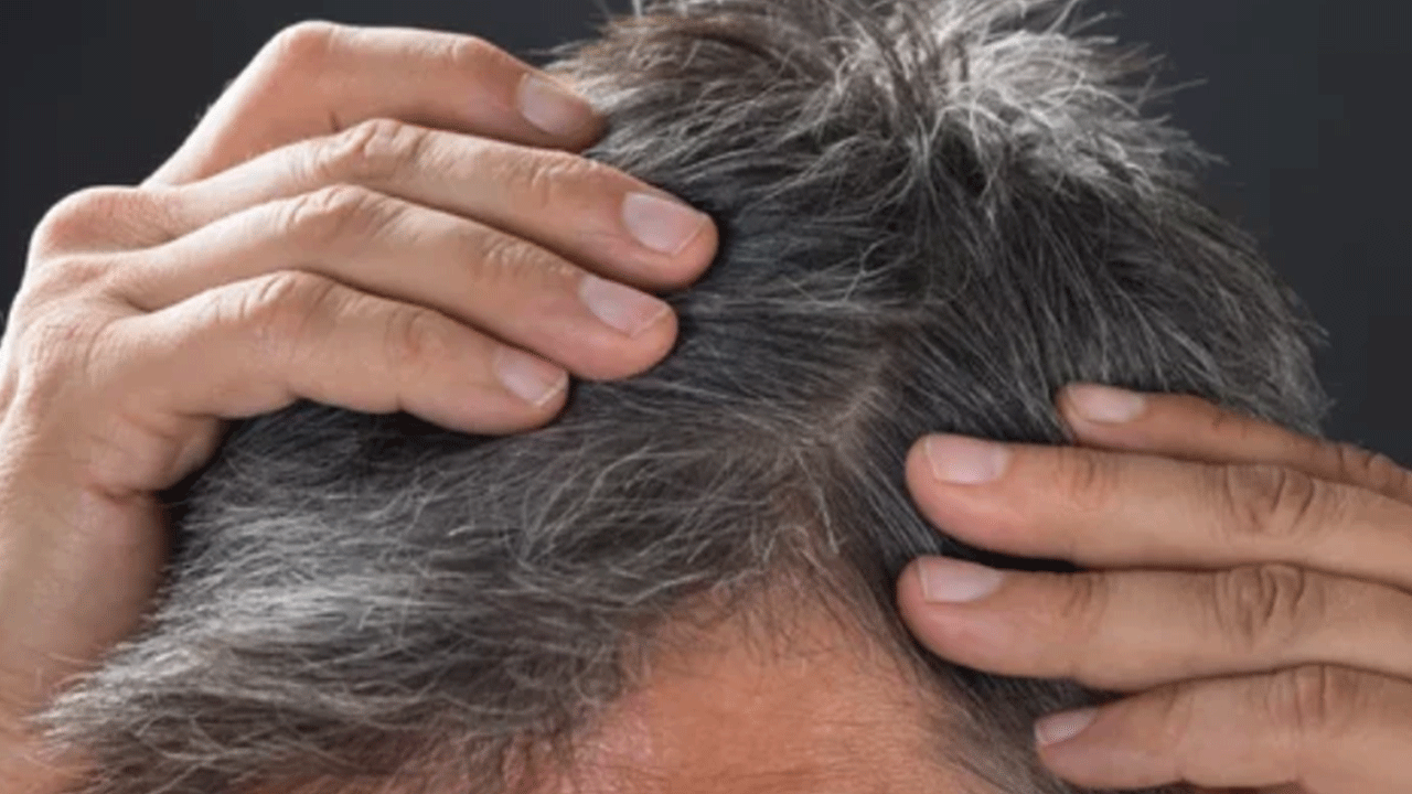 Foto - Bilim adamları son noktayı koydu: İşte erken yaşta saçların beyazlama nedeni!