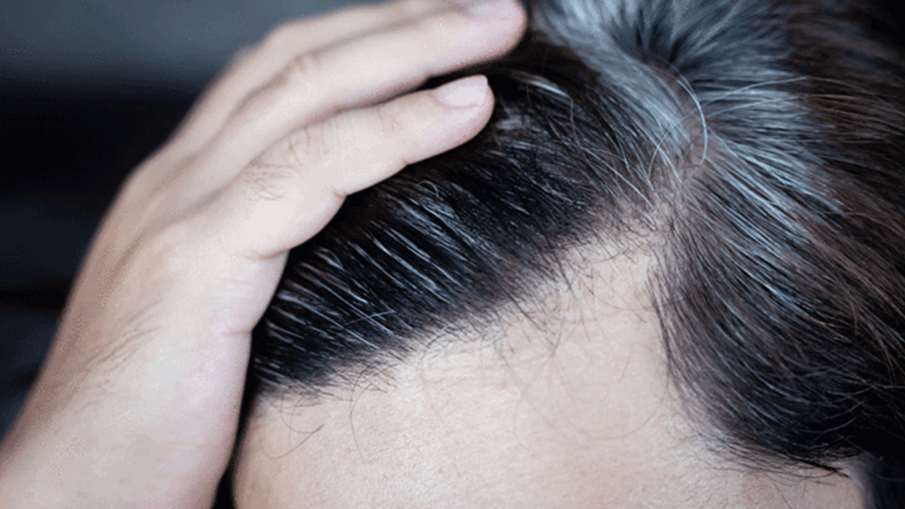 Foto - Bilim adamları son noktayı koydu: İşte erken yaşta saçların beyazlama nedeni!