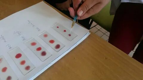 Foto - Bilim adamlarından dikkat çeken araştırma! En dirençli kan grubu belli oldu