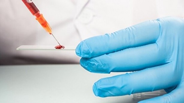 Foto - Bilim adamlarından dikkat çeken araştırma! En dirençli kan grubu belli oldu