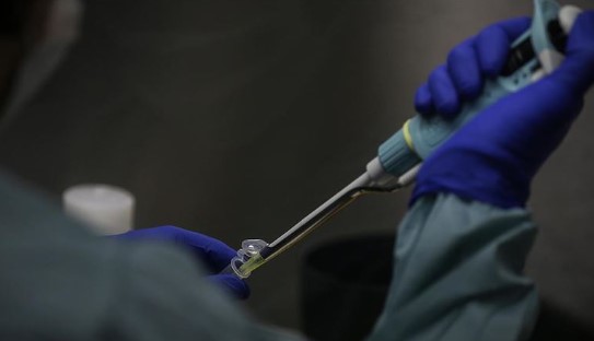 Foto - Bilim adamlarından ilginç araştırma! Bazı kişilerin neden Kovid olmadığı ortaya çıktı