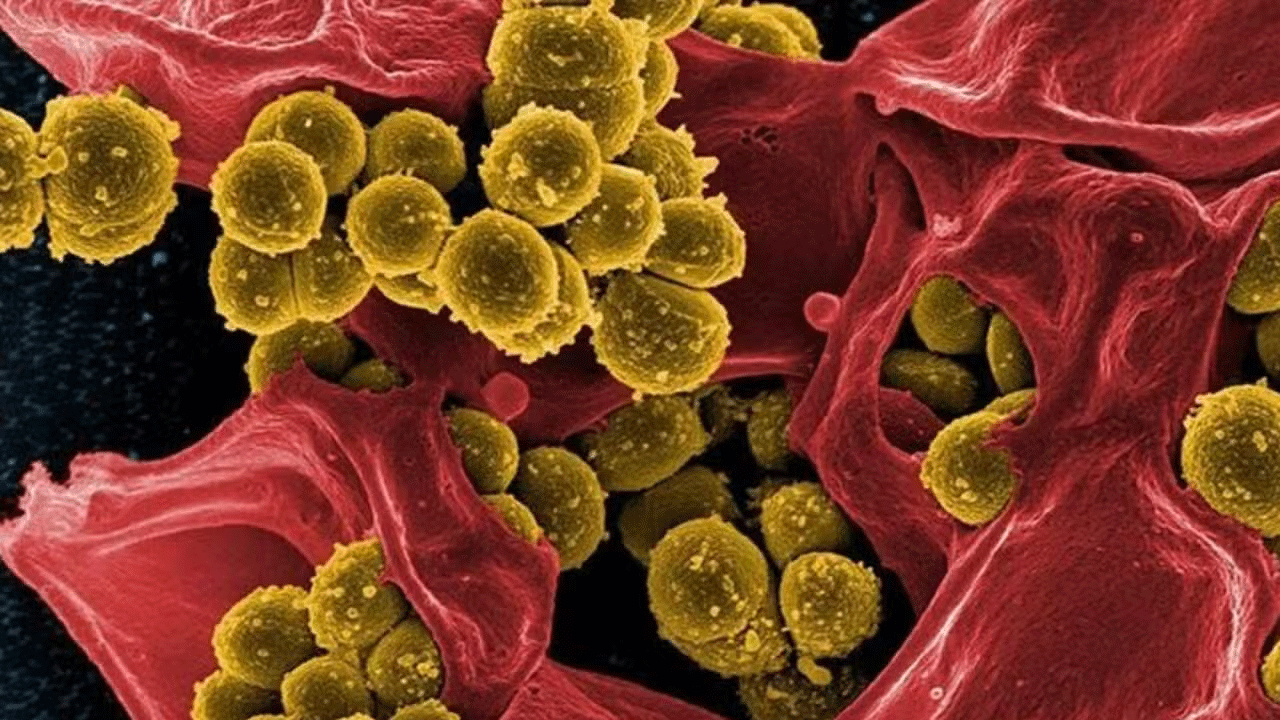 Foto - Bilim adamlarından küresel çağrı: Malezya'da tespit edildi! 