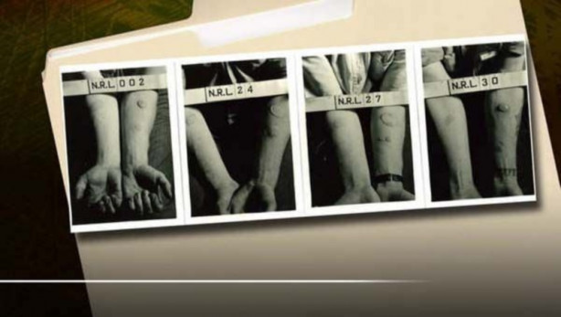 Foto - Bilim adına yapılmış acımasız deneyler...