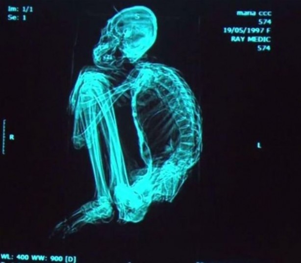 Foto - Bilim dünyası bunu açıklayamıyor