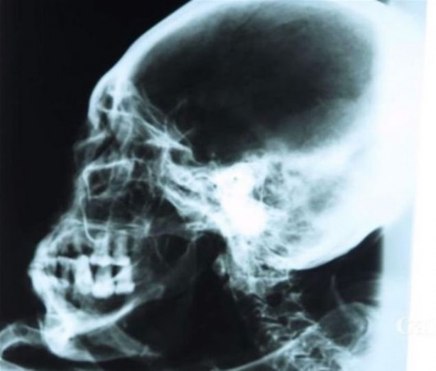 Foto - Bilim dünyası bunu açıklayamıyor