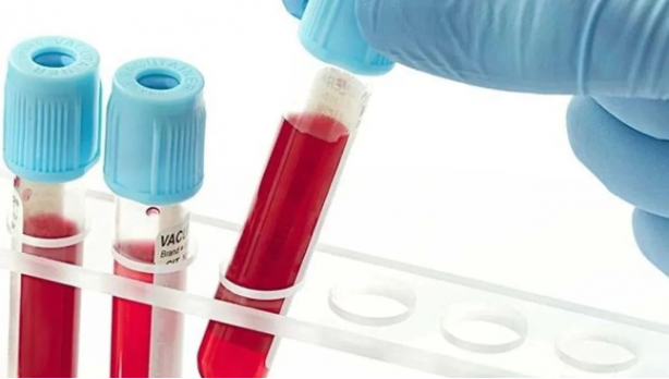 Foto - Bilim insanları açıkladı: İşte en zeki kan grubu!