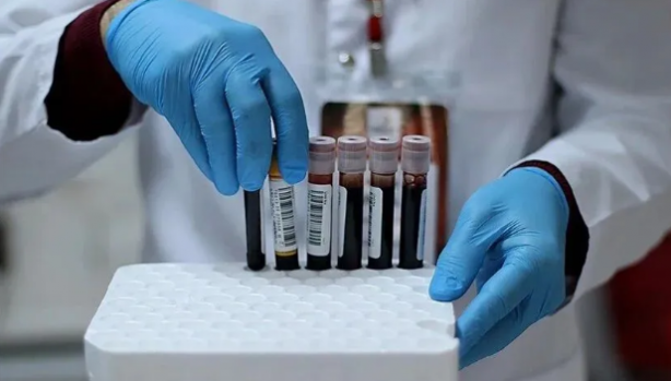 Foto - Bilim insanları açıkladı: İşte en zeki kan grubu!