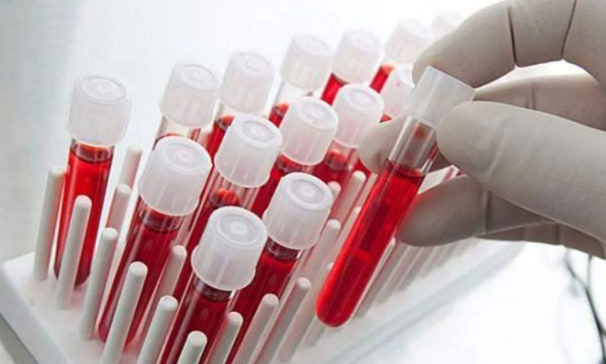 Foto - Bilim insanları açıkladı: İşte en zeki kan grubu!