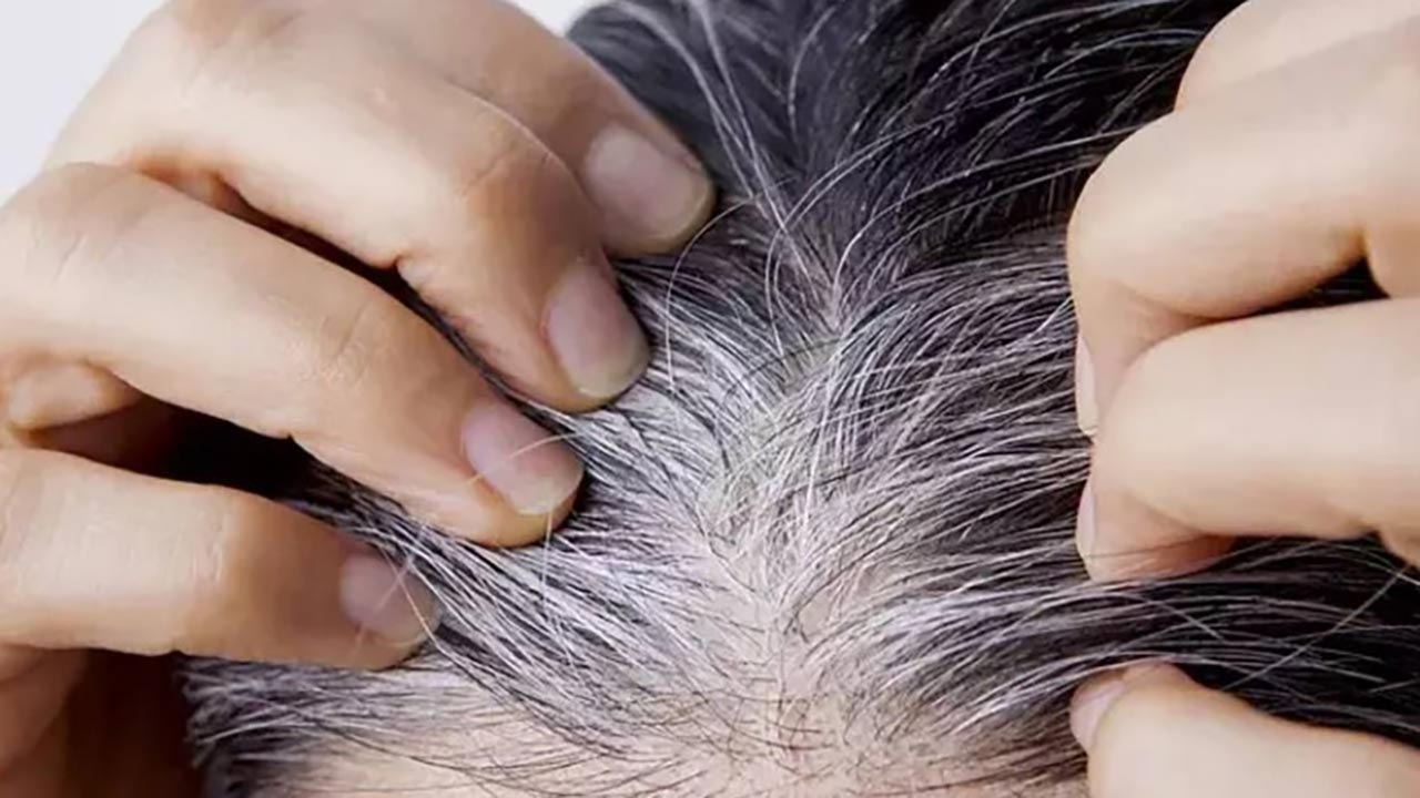Foto - Bilim insanları açıkladı! Saç beyazlamasının nedeni belli oldu