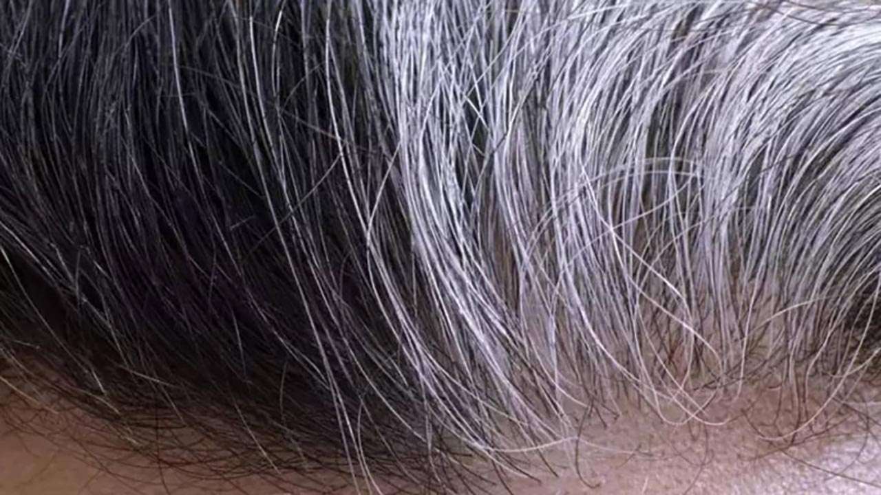 Bilim insanları açıkladı! Saç beyazlamasının nedeni belli oldu