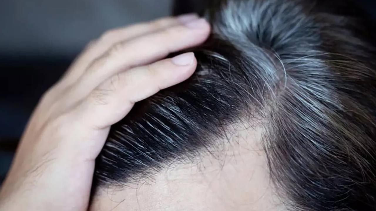 Foto - Bilim insanları açıkladı! Saç beyazlamasının nedeni belli oldu