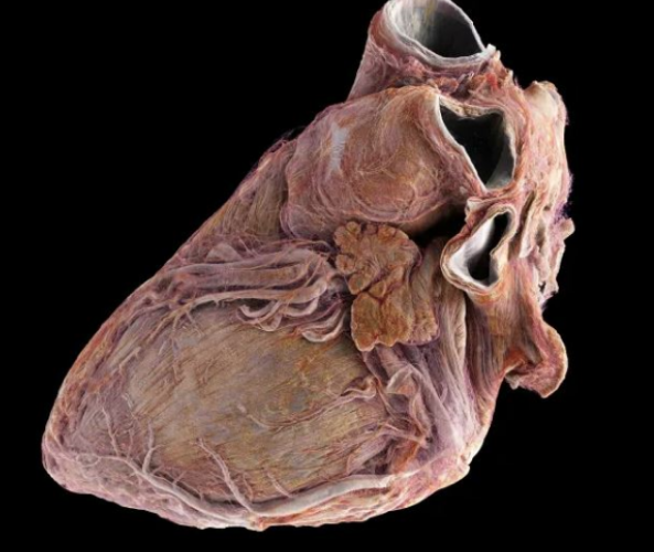 Bilim insanları, insan kalbinin iç yapısını ayrıntılı olarak gösteren, Google Earth'e benzer yeni bir teknoloji geliştirdi 