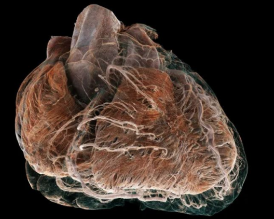 Foto - Bilim insanları, insan kalbinin iç yapısını ayrıntılı olarak gösteren, Google Earth'e benzer yeni bir teknoloji geliştirdi 