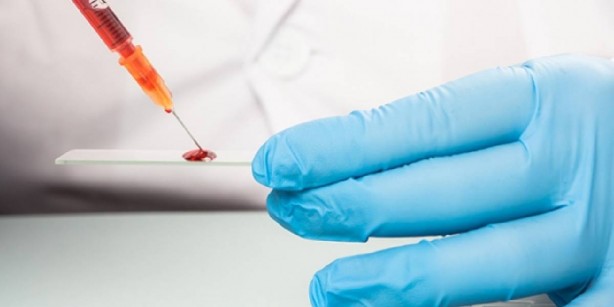 Foto - Bilimsel olarak kanıtlandı! Bu kan grubundaki kişiler yüksek IQ’ya sahip! İşte en zeki kan grupları