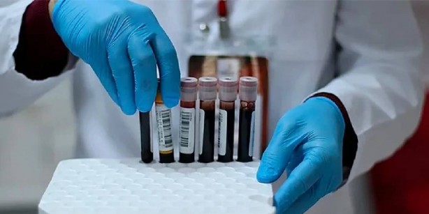 Foto - Bilimsel olarak kanıtlandı! Bu kan grubundaki kişiler yüksek IQ’ya sahip! İşte en zeki kan grupları