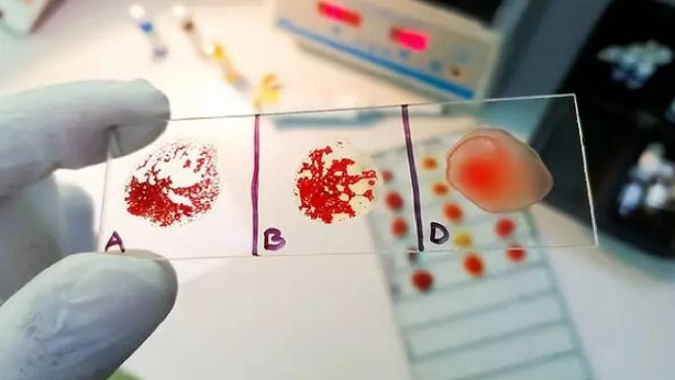 Bilimsel olarak kanıtlandı! Bu kan grubundaki kişiler yüksek IQ’ya sahip! İşte en zeki kan grupları