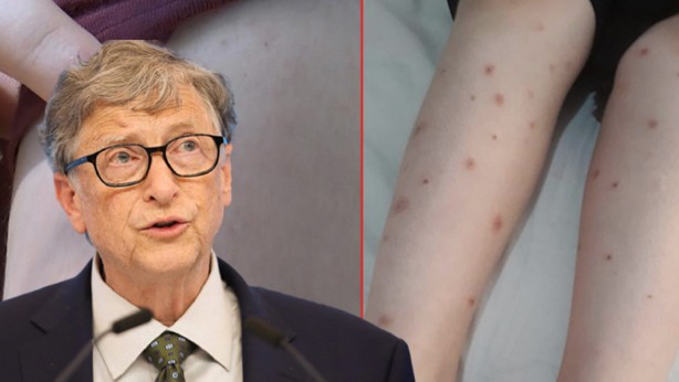 Foto - Bill Gates hepsini Türkiye'ye mi saldı? Gündemi altüst edecek gelişme