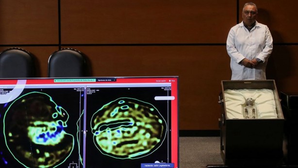 Bin yaşında oldukları söyleniyor! Dünyada ilk kez uzaylı kalıntısı kamuoyuna gösterildi! Bu fotoğrafları görünce nutkunuz tutulacak