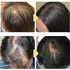 Foto - Binbir derde deva olan çörek otunun faydaları: Öyle bir şey ki, böyle şifa görülmedi! Çoğu kişi kullanıyor