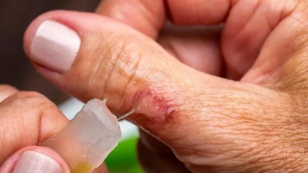 Foto - Bir an bile yüzüne bakmayacağımız karbonatın faydaları! İşte cildinizi canlı tutan, gözaltında problemi silen...