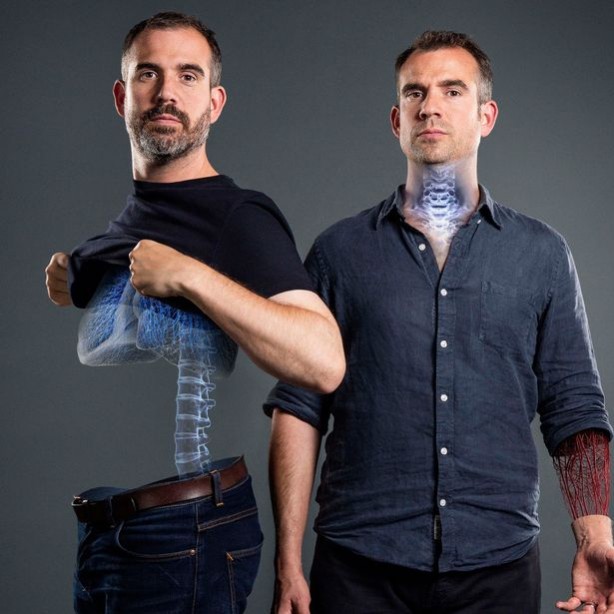 Foto - Bir ay boyunca hamburger ekmek yerseniz bakın ne oluyor! İngiliz doktor denedi... Şok oldu