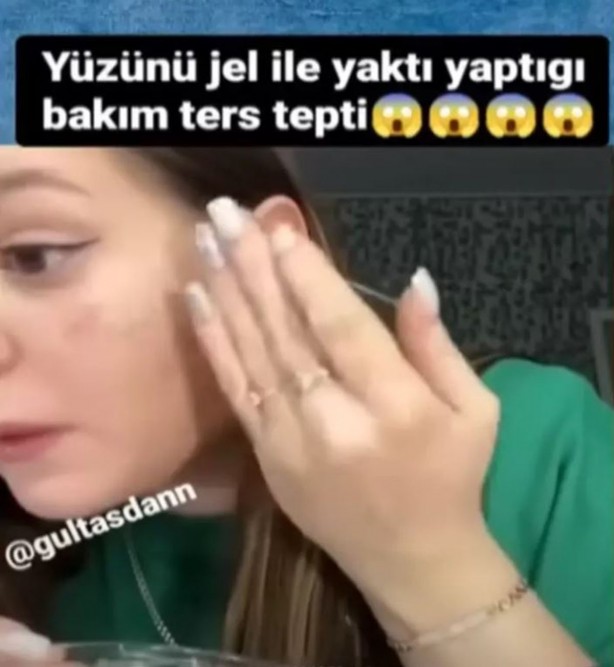 Foto - Bir bu eksikti! Sosyal medyadaki son kepazelik bu oldu! Birçok kişi o akıma uyup video çekiyor