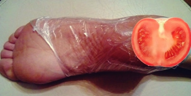 Bir dilim domatesi ayağınıza koyarsanız...