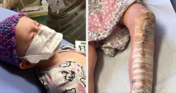 Foto - Bir gece ansızın bacağı ağrımaya başladı ve teşhis konuldu! Kanser!