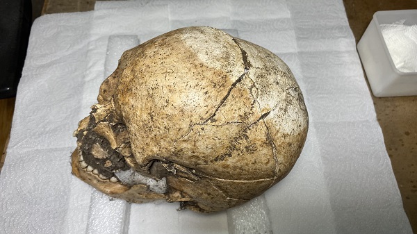 Foto - Bir ilk yaşanacak! Kazıda bulunan Troyalı kafatası yüzlendirilecek