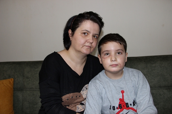 Foto - Bir sokak köpeği dehşeti daha! Yüzüne tam 60 dikiş atıldı