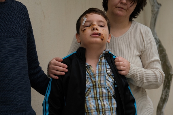 Foto - Bir sokak köpeği dehşeti daha! Yüzüne tam 60 dikiş atıldı