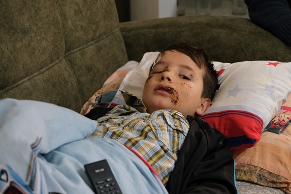 Foto - Bir sokak köpeği dehşeti daha! Yüzüne tam 60 dikiş atıldı