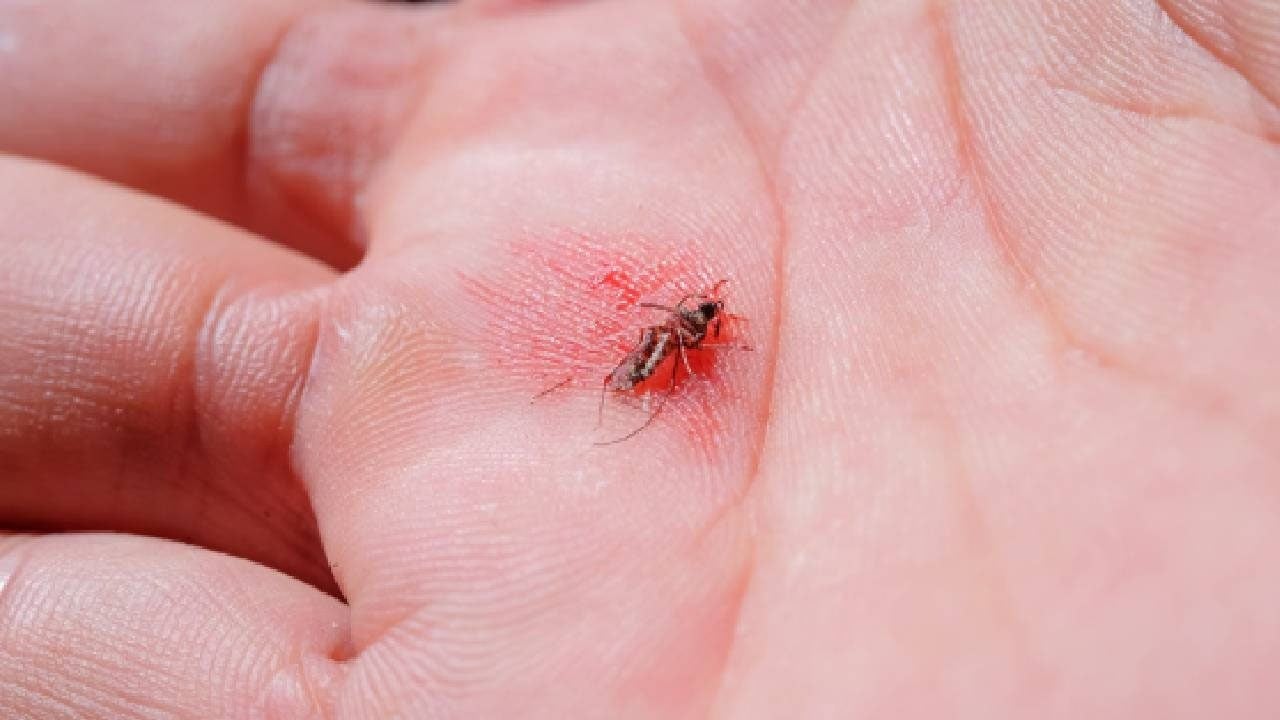 Foto - Bir vaka daha patladı: Orada 307 kişi öldü, 100 bin kişi hastanelik oldu... Çağrı yapıldı