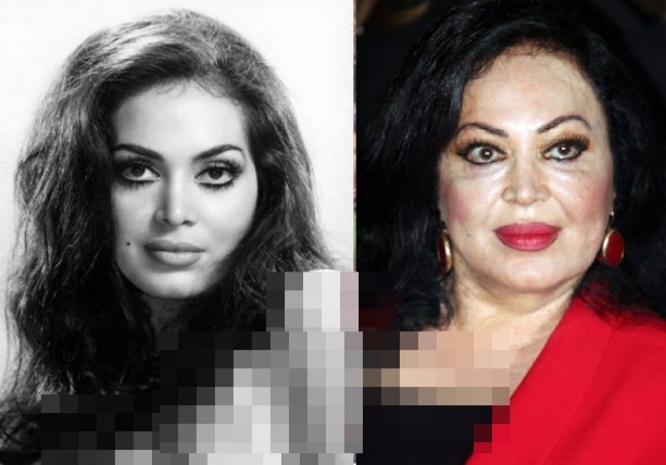 Foto - Bir zamanın 'artist'leri bakın şimdi ne hâlde?