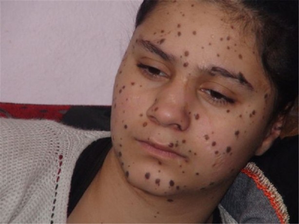 Foto - Birbirinden ilginç bilimsel araştıma sonuçları