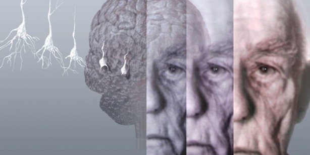 Foto - Birçok kişi bilmiyor! İşte alzheimer ile unutkanlik arasinda 10 önemli fark!